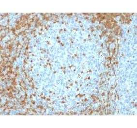 Immunohistochemistry - Anti-ZAP70 Antibody [ZAP70/2035] - BSA and Azide free (A253524) - Antibodies.com