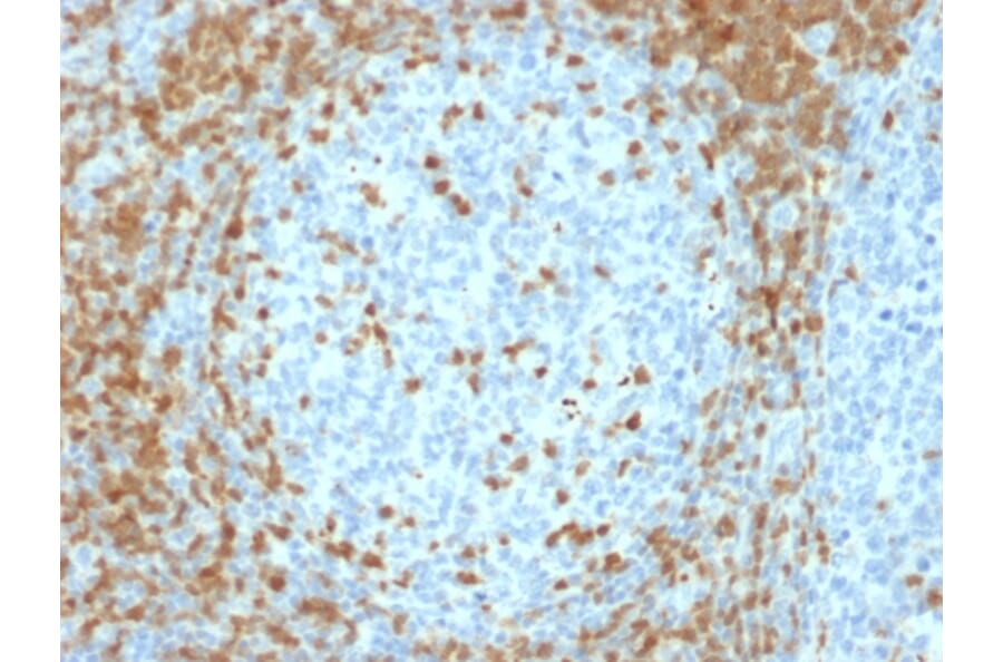 Immunohistochemistry - Anti-ZAP70 Antibody [ZAP70/2035] - BSA and Azide free (A253524) - Antibodies.com