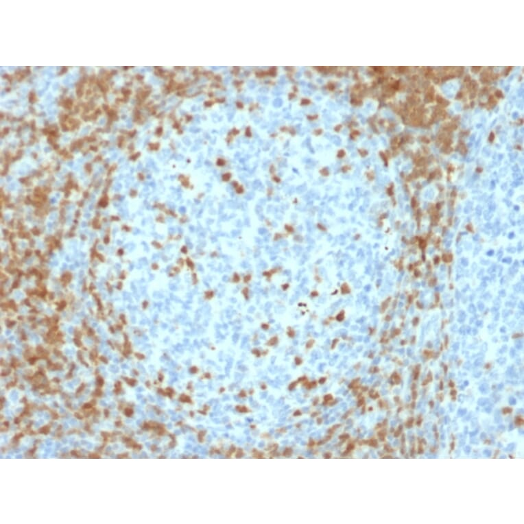 Immunohistochemistry - Anti-ZAP70 Antibody [ZAP70/2035] - BSA and Azide free (A253524) - Antibodies.com