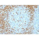 Immunohistochemistry - Anti-ZAP70 Antibody [ZAP70/2035] - BSA and Azide free (A253524) - Antibodies.com