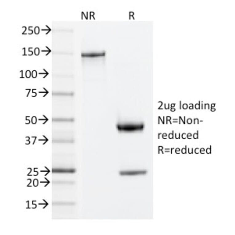 SDS-PAGE - Anti-ZAP70 Antibody [ZAP70/2035] - BSA and Azide free (A253524) - Antibodies.com