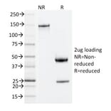 SDS-PAGE - Anti-ZAP70 Antibody [ZAP70/2035] - BSA and Azide free (A253524) - Antibodies.com