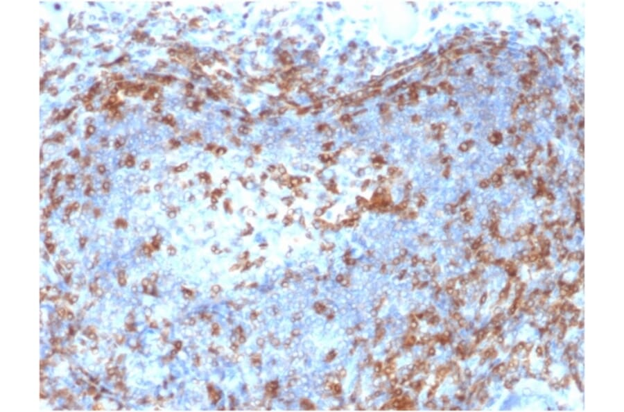 Immunohistochemistry - Anti-ZAP70 Antibody [ZAP70/2046] - BSA and Azide free (A253525) - Antibodies.com