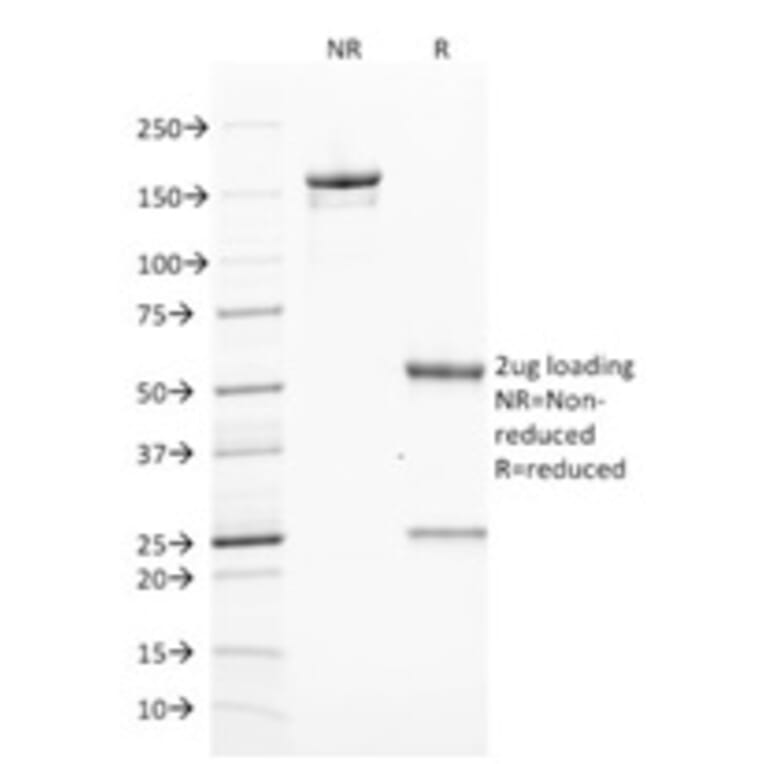 SDS-PAGE - Anti-ZAP70 Antibody [ZAP70/2046] - BSA and Azide free (A253525) - Antibodies.com