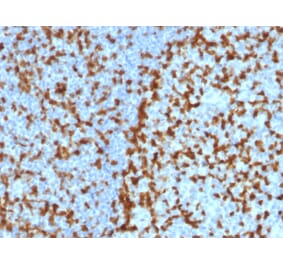 Immunohistochemistry - Anti-ZAP70 Antibody [ZAP70/2047] - BSA and Azide free (A253526) - Antibodies.com