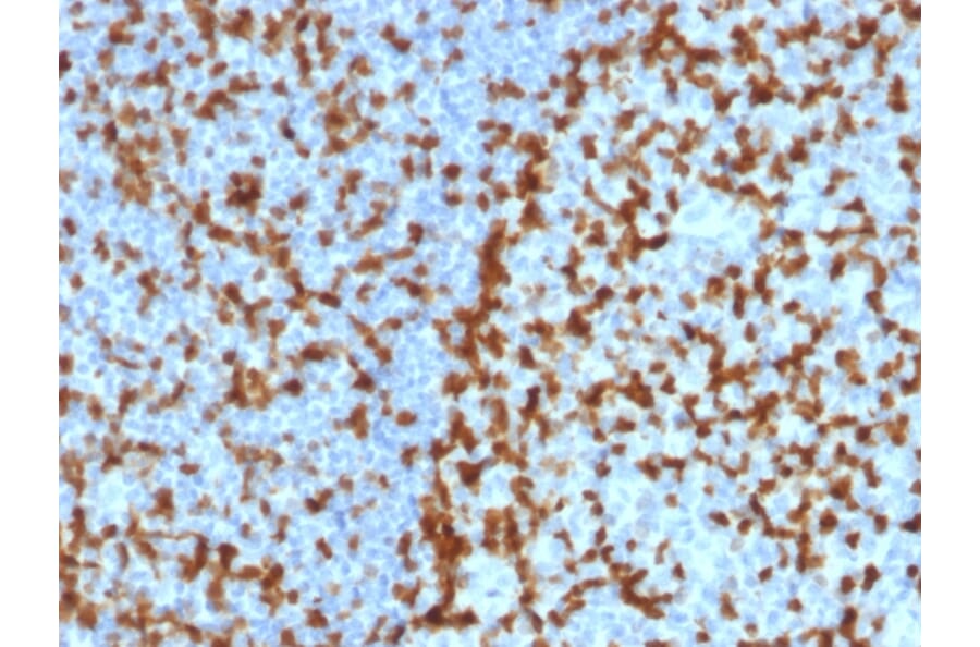 Immunohistochemistry - Anti-ZAP70 Antibody [ZAP70/2047] - BSA and Azide free (A253526) - Antibodies.com