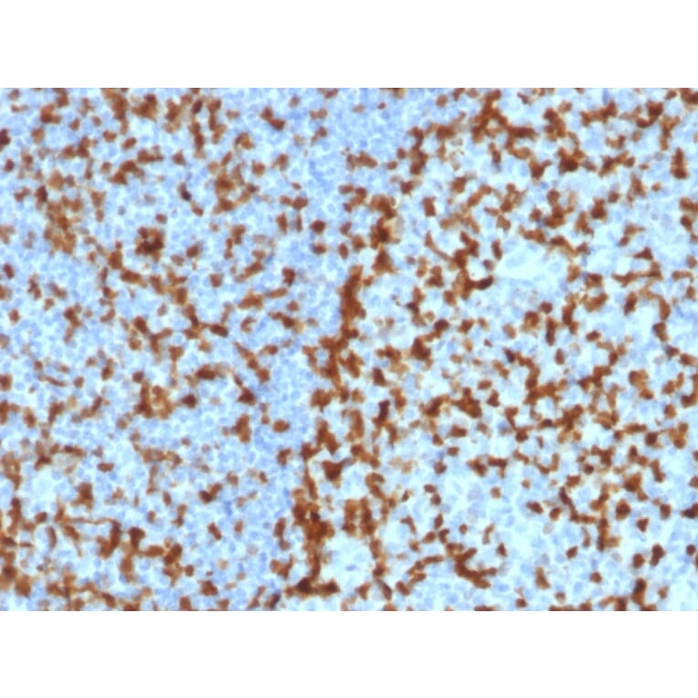 Immunohistochemistry - Anti-ZAP70 Antibody [ZAP70/2047] - BSA and Azide free (A253526) - Antibodies.com