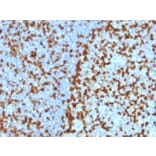 Immunohistochemistry - Anti-ZAP70 Antibody [ZAP70/2047] - BSA and Azide free (A253526) - Antibodies.com