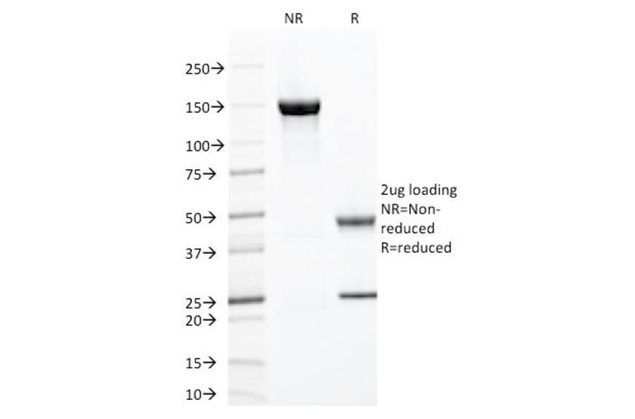 SDS-PAGE - Anti-ZAP70 Antibody [ZAP70/2047] - BSA and Azide free (A253526) - Antibodies.com