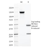 SDS-PAGE - Anti-ZAP70 Antibody [ZAP70/2047] - BSA and Azide free (A253526) - Antibodies.com