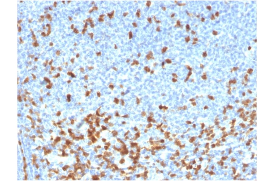 Immunohistochemistry - Anti-ZAP70 Antibody [rZAP70/2046] - BSA and Azide free (A253526) - Antibodies.com
