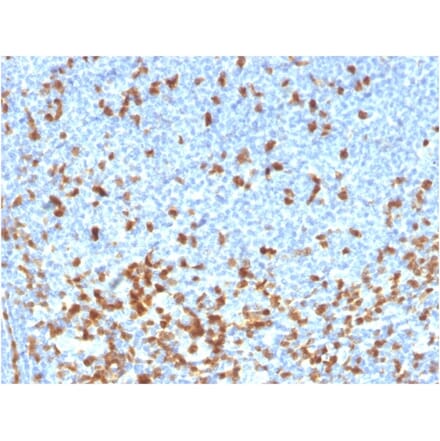 Immunohistochemistry - Anti-ZAP70 Antibody [rZAP70/2046] - BSA and Azide free (A253526) - Antibodies.com