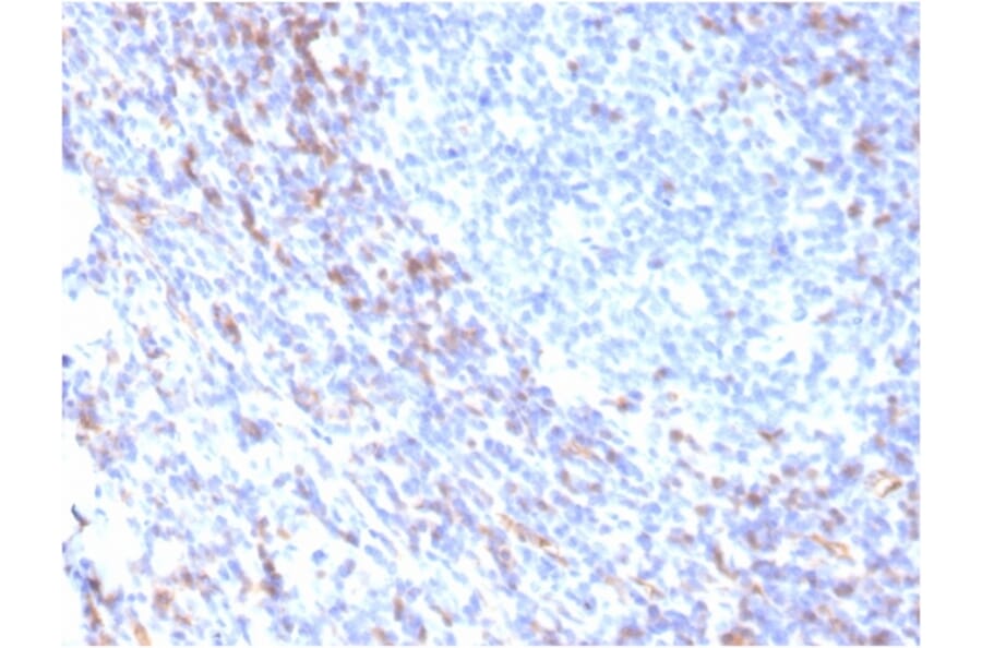 Immunohistochemistry - Anti-ZAP70 Antibody [rZAP70/2046] - BSA and Azide free (A253527) - Antibodies.com