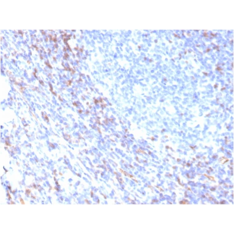 Immunohistochemistry - Anti-ZAP70 Antibody [rZAP70/2046] - BSA and Azide free (A253527) - Antibodies.com