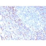Immunohistochemistry - Anti-ZAP70 Antibody [rZAP70/2046] - BSA and Azide free (A253527) - Antibodies.com