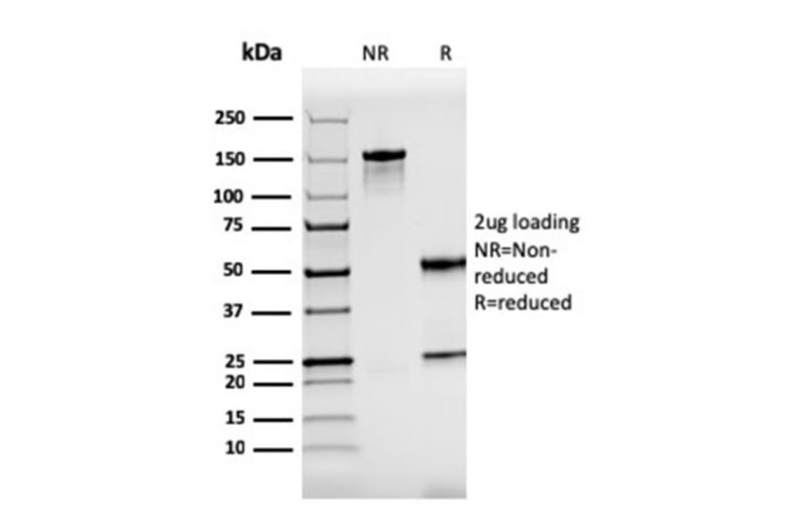SDS-PAGE - Anti-ZAP70 Antibody [rZAP70/2046] - BSA and Azide free (A253527) - Antibodies.com