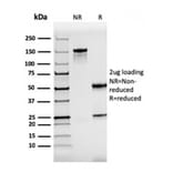 SDS-PAGE - Anti-ZAP70 Antibody [rZAP70/2046] - BSA and Azide free (A253527) - Antibodies.com