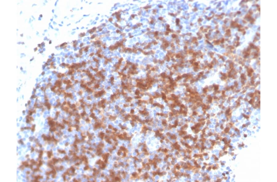 Immunohistochemistry - Anti-ZAP70 Antibody [ZAP70/4040R] - BSA and Azide free (A253527) - Antibodies.com