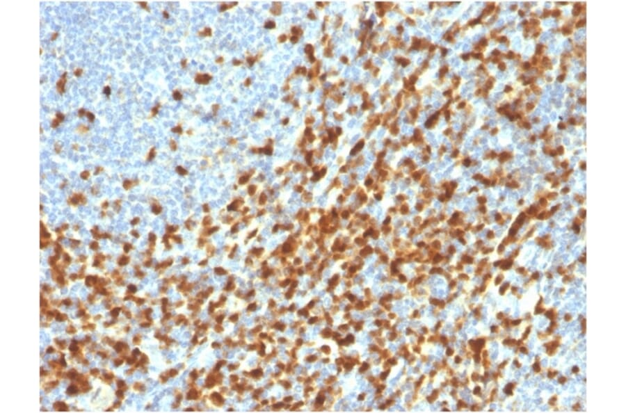 Immunohistochemistry - Anti-ZAP70 Antibody [ZAP70/3921R] - BSA and Azide free (A253528) - Antibodies.com