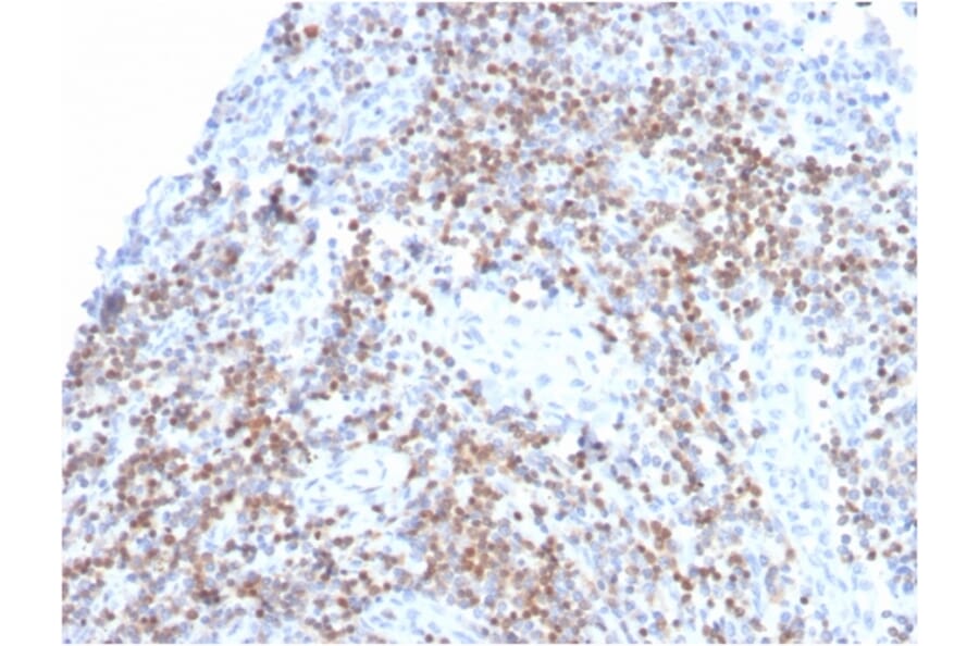 Immunohistochemistry - Anti-ZAP70 Antibody [ZAP70/3921R] - BSA and Azide free (A253529) - Antibodies.com
