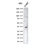 Western Blot - Anti-Carbonic Anhydrase VIII Antibody [CPTC-CA8-2] - BSA and Azide free (A253530) - Antibodies.com