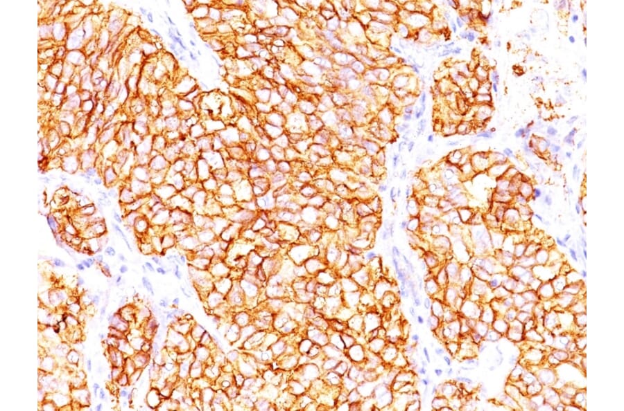 Immunohistochemistry - Anti-Carbonic Anhydrase IX Antibody [66.4.C2] - BSA and Azide free (A253530) - Antibodies.com