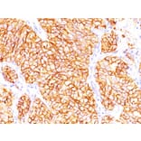 Immunohistochemistry - Anti-Carbonic Anhydrase IX Antibody [66.4.C2] - BSA and Azide free (A253530) - Antibodies.com