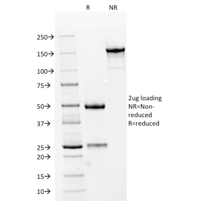 SDS-PAGE - Anti-Carbonic Anhydrase IX Antibody [66.4.C2] - BSA and Azide free (A253531) - Antibodies.com