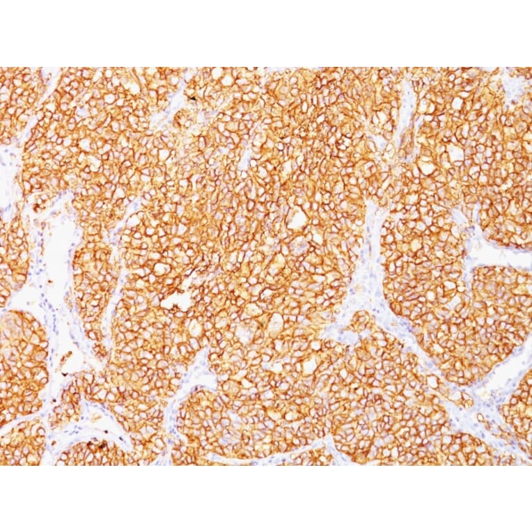Immunohistochemistry - Anti-Carbonic Anhydrase IX Antibody [SPM314] - BSA and Azide free (A253531) - Antibodies.com