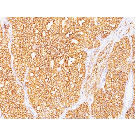 Immunohistochemistry - Anti-Carbonic Anhydrase IX Antibody [SPM487] - BSA and Azide free (A253532) - Antibodies.com