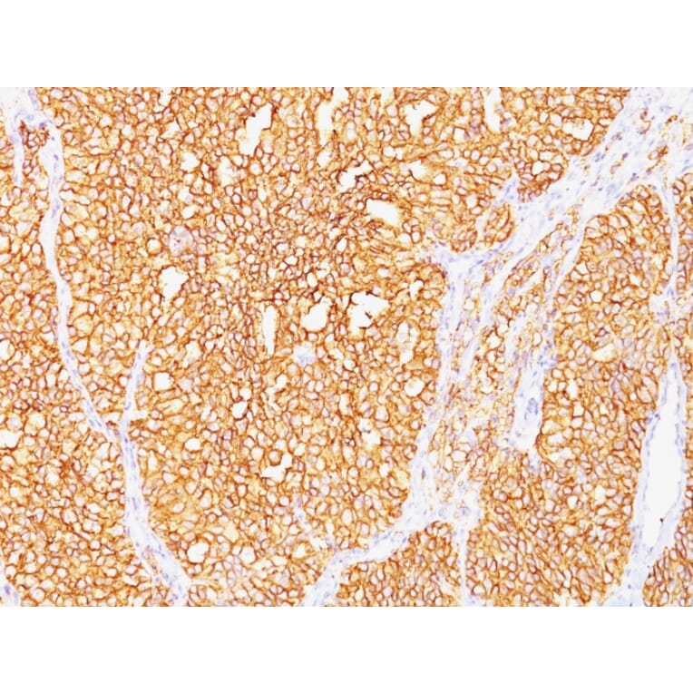 Immunohistochemistry - Anti-Carbonic Anhydrase IX Antibody [SPM487] - BSA and Azide free (A253532) - Antibodies.com