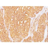 Immunohistochemistry - Anti-Carbonic Anhydrase IX Antibody [SPM487] - BSA and Azide free (A253532) - Antibodies.com