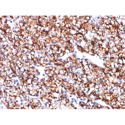Immunohistochemistry - Anti-Carbonic Anhydrase IX Antibody [CA9/781] - BSA and Azide free (A253533) - Antibodies.com