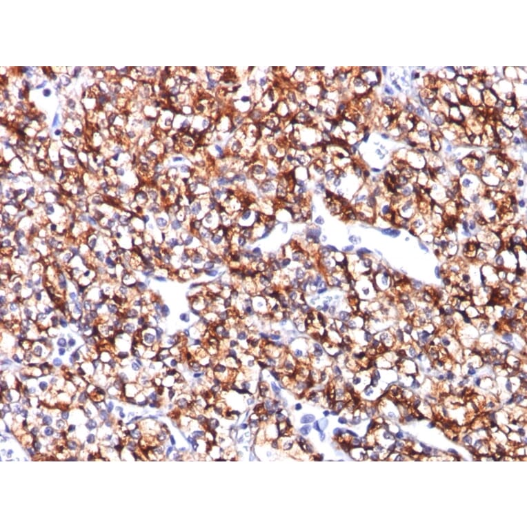 Immunohistochemistry - Anti-Carbonic Anhydrase IX Antibody [CA9/781] - BSA and Azide free (A253533) - Antibodies.com