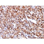 Immunohistochemistry - Anti-Carbonic Anhydrase IX Antibody [CA9/781] - BSA and Azide free (A253533) - Antibodies.com