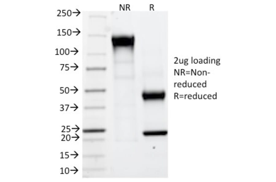 SDS-PAGE - Anti-Carbonic Anhydrase IX Antibody [CA9/781] - BSA and Azide free (A253534) - Antibodies.com