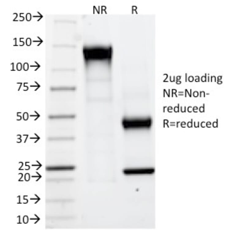 SDS-PAGE - Anti-Carbonic Anhydrase IX Antibody [CA9/781] - BSA and Azide free (A253534) - Antibodies.com