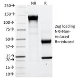 SDS-PAGE - Anti-Carbonic Anhydrase IX Antibody [CA9/781] - BSA and Azide free (A253534) - Antibodies.com