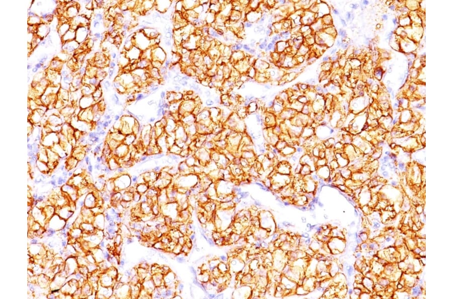 Immunohistochemistry - Anti-Carbonic Anhydrase IX Antibody [PN-15] - BSA and Azide free (A253534) - Antibodies.com