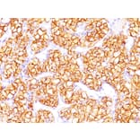 Immunohistochemistry - Anti-Carbonic Anhydrase IX Antibody [PN-15] - BSA and Azide free (A253534) - Antibodies.com