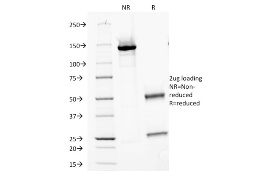 SDS-PAGE - Anti-Carbonic Anhydrase IX Antibody [PN-15] - BSA and Azide free (A253535) - Antibodies.com