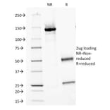 SDS-PAGE - Anti-Carbonic Anhydrase IX Antibody [PN-15] - BSA and Azide free (A253535) - Antibodies.com