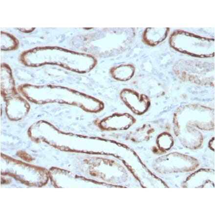 Immunohistochemistry - Anti-Carbonic Anhydrase IX Antibody [CA9/3405] - BSA and Azide free (A253536) - Antibodies.com