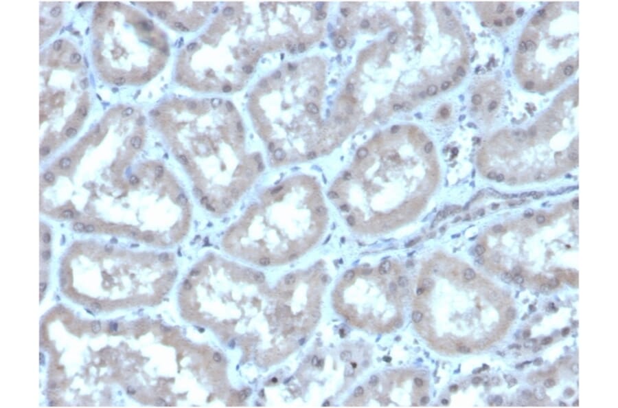 Immunohistochemistry - Anti-Carbonic Anhydrase IX Antibody [CA9/3406] - BSA and Azide free (A253537) - Antibodies.com