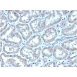 Immunohistochemistry - Anti-Carbonic Anhydrase IX Antibody [CA9/3406] - BSA and Azide free (A253537) - Antibodies.com