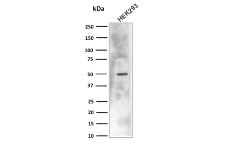 Western Blot - Anti-Carbonic Anhydrase IX Antibody [CA9/3406] - BSA and Azide free (A253537) - Antibodies.com