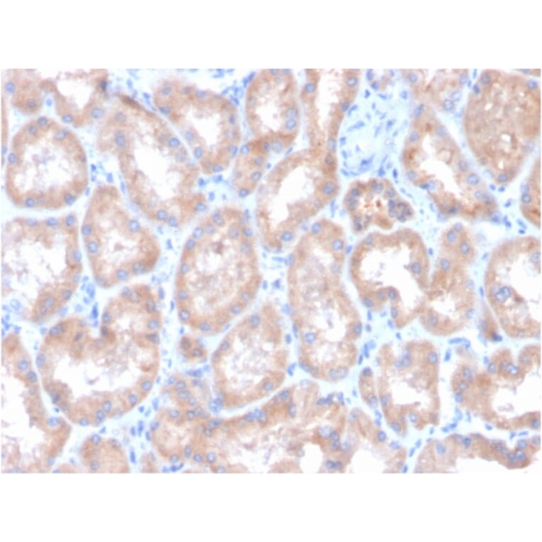 Immunohistochemistry - Anti-Carbonic Anhydrase IX Antibody [CA9/3407] - BSA and Azide free (A253538) - Antibodies.com