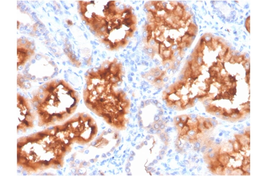Immunohistochemistry - Anti-Carbonic Anhydrase IX Antibody [CA9/3407] - BSA and Azide free (A253538) - Antibodies.com