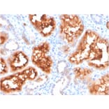 Immunohistochemistry - Anti-Carbonic Anhydrase IX Antibody [CA9/3407] - BSA and Azide free (A253538) - Antibodies.com