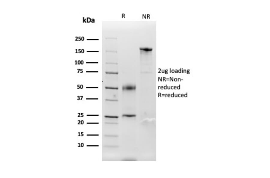 SDS-PAGE - Anti-Carbonic Anhydrase IX Antibody [CA9/3407] - BSA and Azide free (A253538) - Antibodies.com